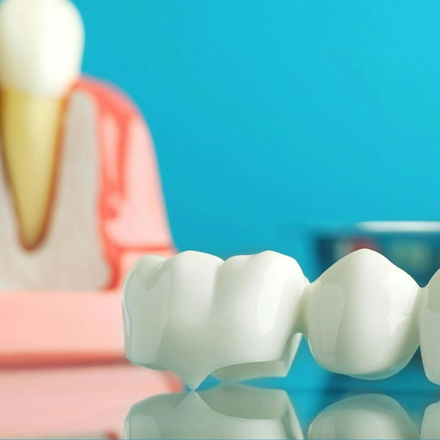 Prosthodontic Services in Keller, TX — anatomical illustration