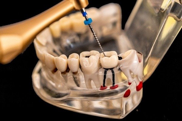Endodontic Care in Keller, TX — anatomical illustration