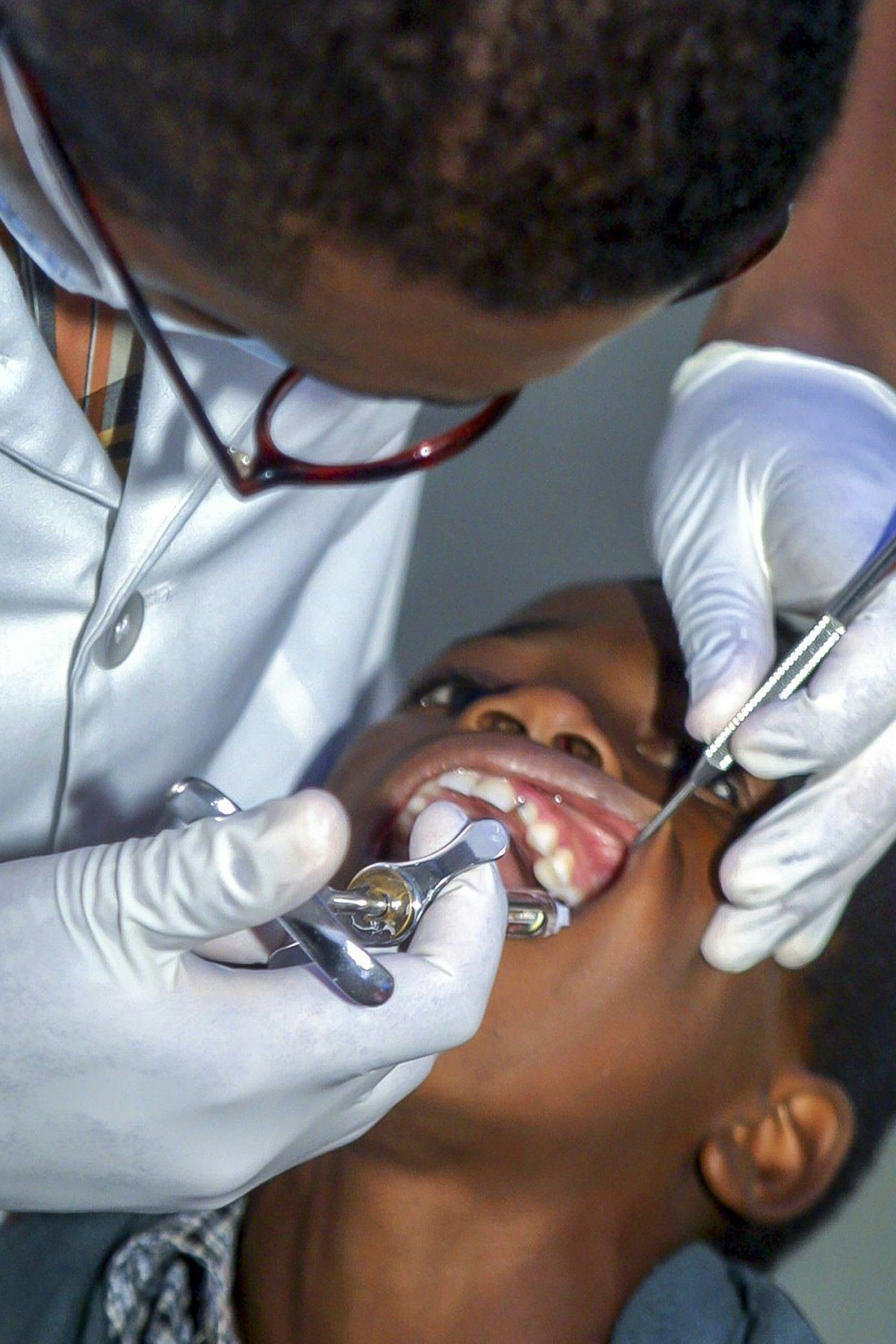 Pediatric Dentistry in Keller, TX — anatomical illustration